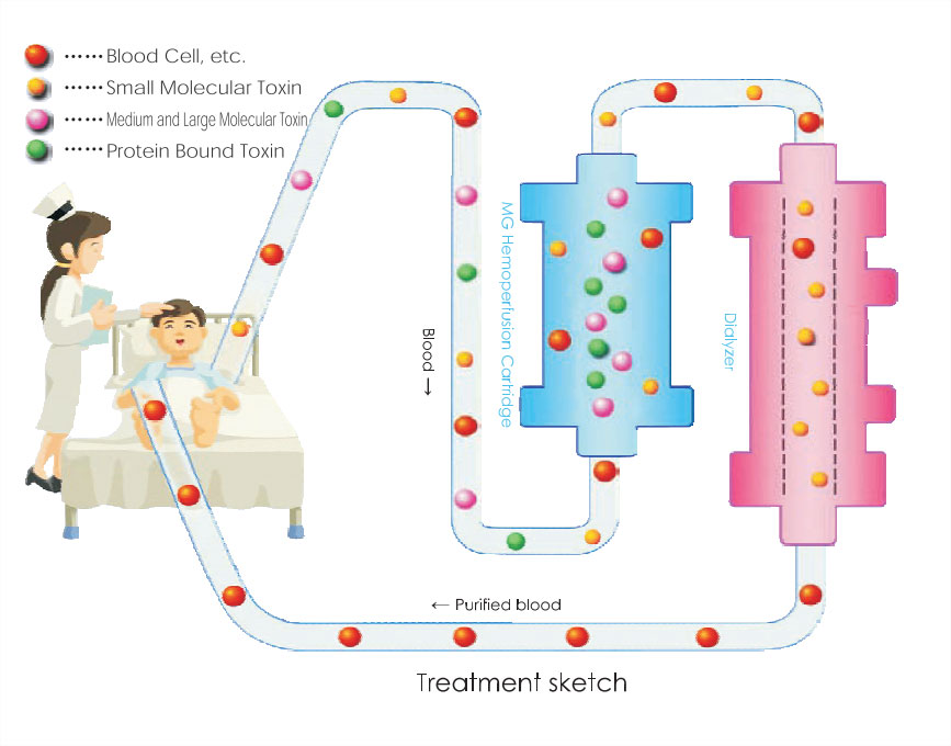 Hemoperfusion treatment sketch