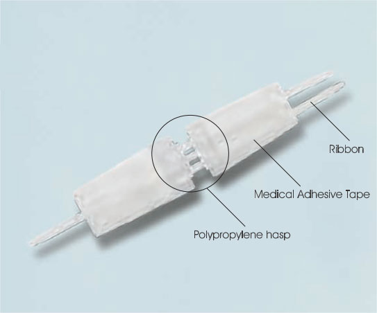 Wound closure device picture two