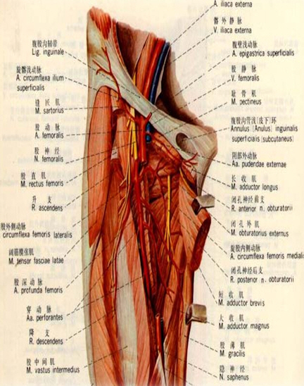 Femoral puncture site - Central venous catheter placement