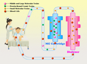 Hemodialysis + hemoperfusion treatment animation